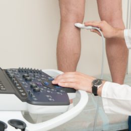 , Lower Limb Venous (Varicose Vein) Ultrasound